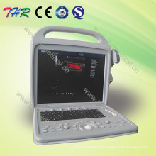 Scanner portátil de ultrassom Doppler colorido (THR-CD580)